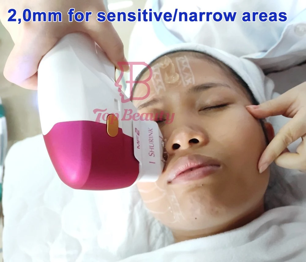 High Intensity Focused Ultrasound Facial Lifting Hifu 7D Hifu Mmfu Wrinkle Removal Machine