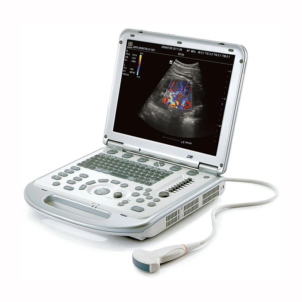 Mindray M7 Laptop Color Doppler Ultrasound