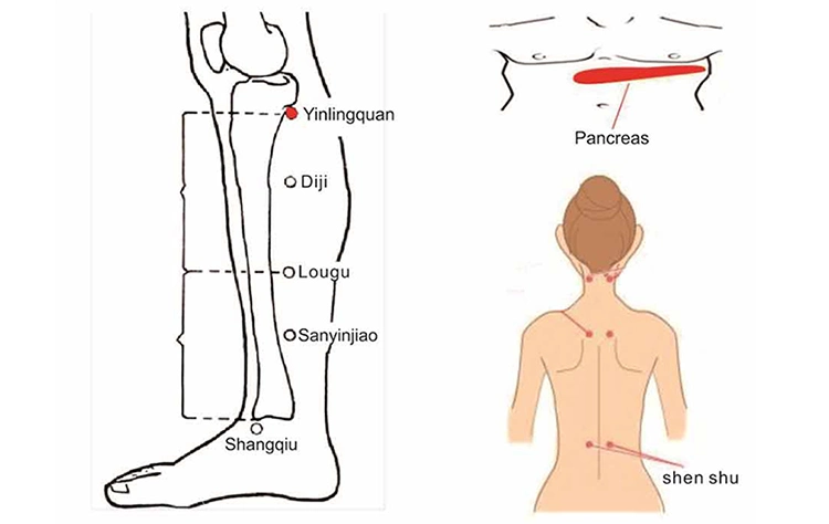 Millimeter Wave Diabetic Disease and Diabetes Therapy Instrument