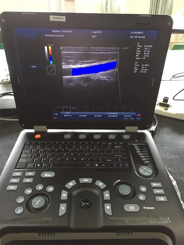 Low Cost Laptop Hospital 3D Color Doppler Ultrasound Scanner China