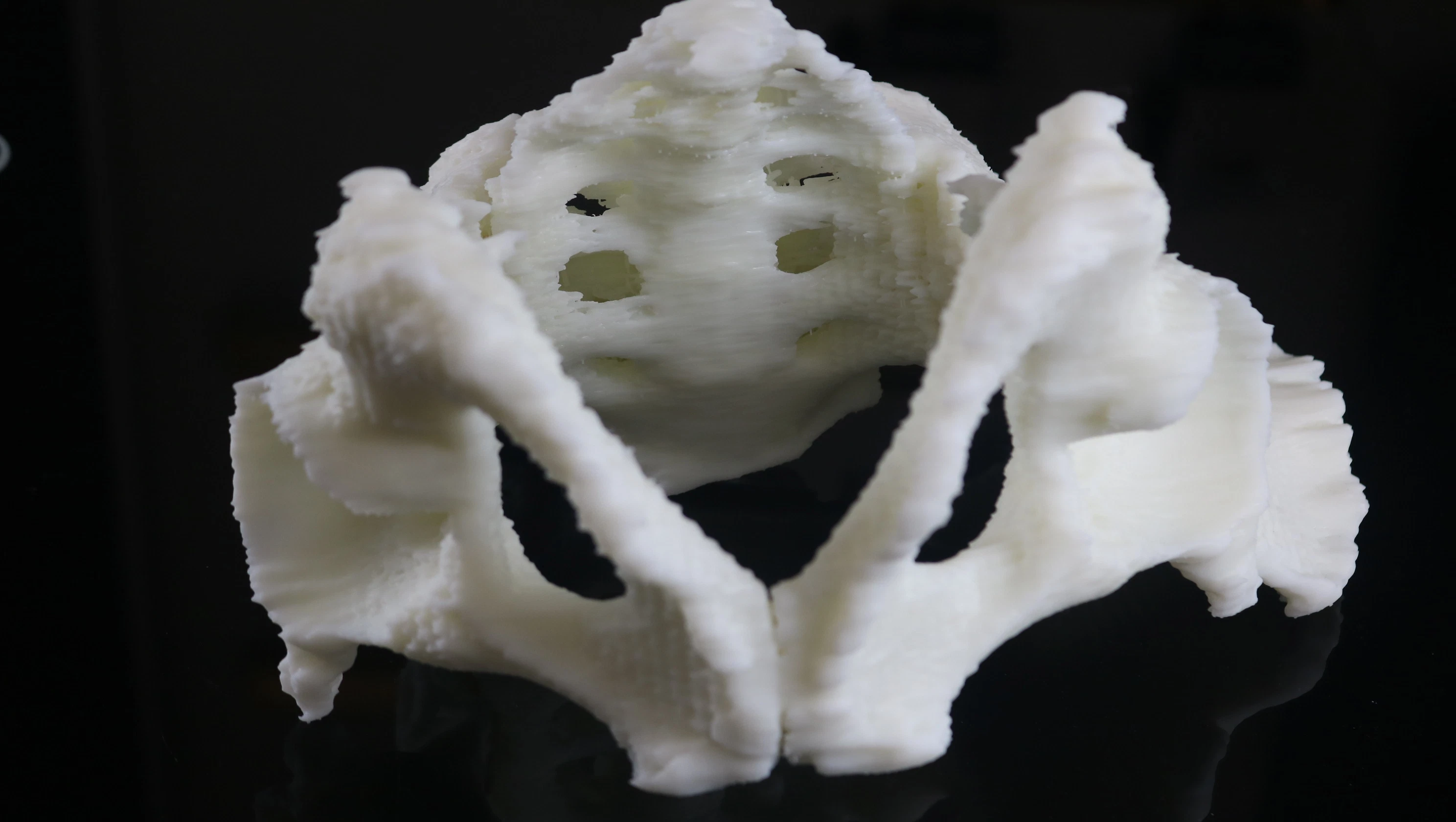 High quality/High cost performance  SLA Resin 3D Printing Service for Zygomatic Model