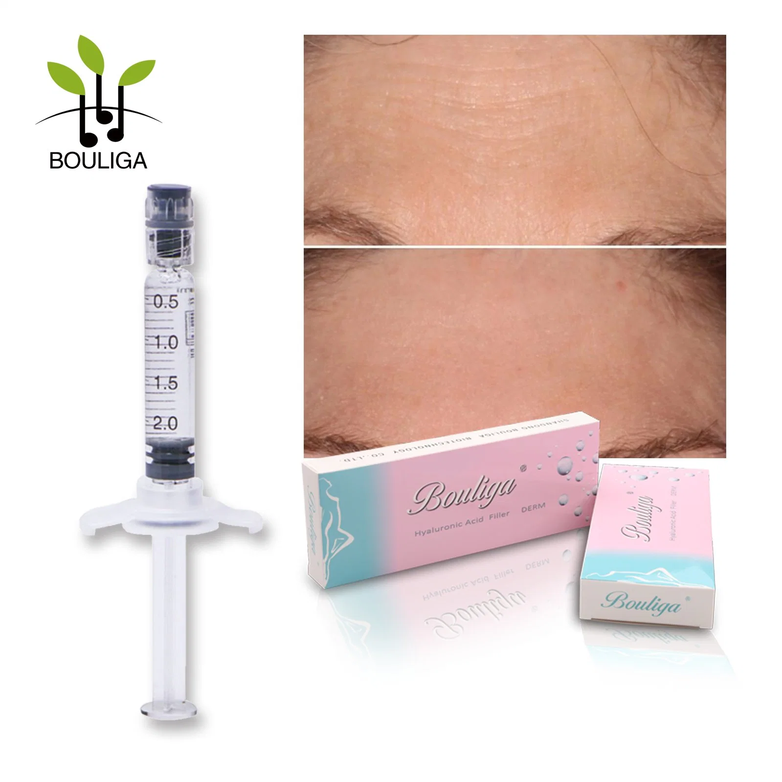 Aged Skin Ha Injection Hyaluronic Acid Lip Filler 2ml