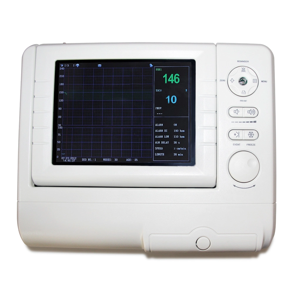 Portable Color Ultrasound Machine Ctg Fetal Monitor