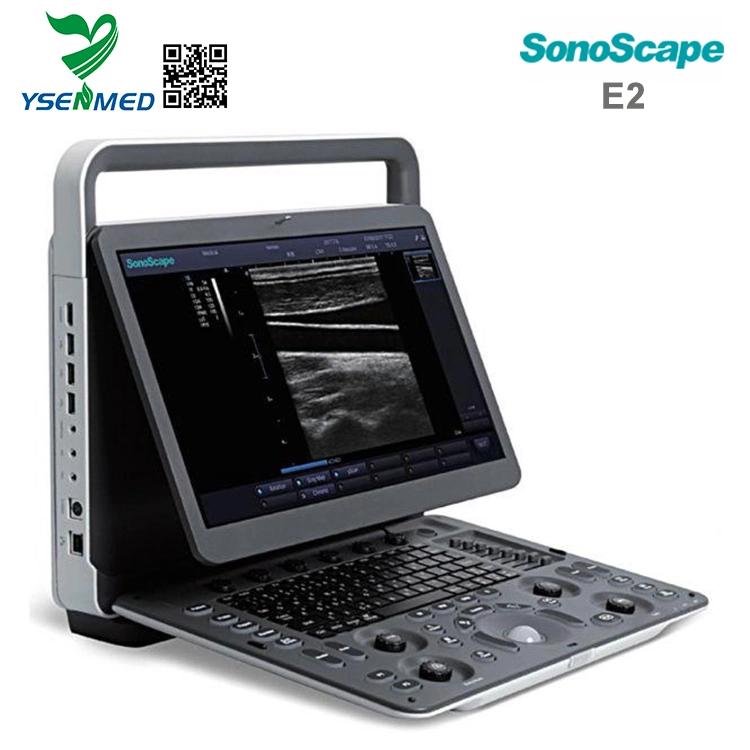 Sonoscape E2 المعدات الطبية أجهزة الكمبيوتر المحمول الرقمية عالية الجودة الموجات فوق الصوتية الماسحة الضوئية