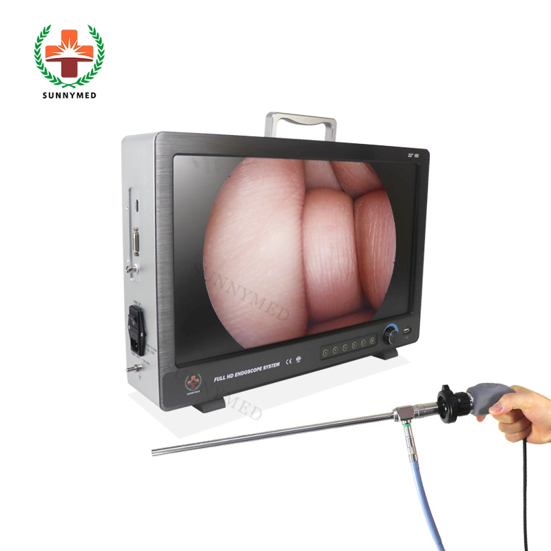 Sy-PS050 Medical 1080P HD Portable Endoscopic/Endoscope HD Camera System for Urology