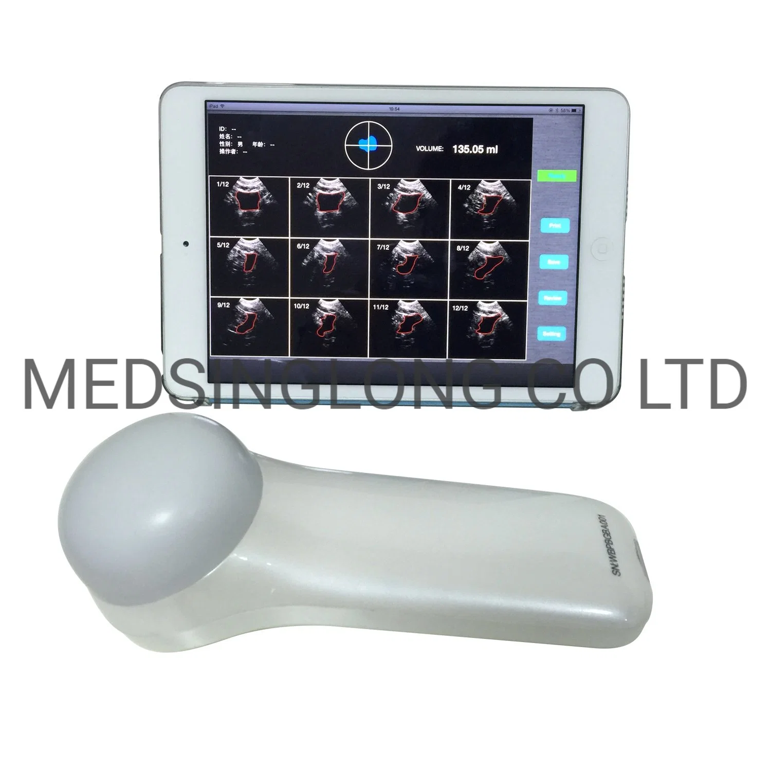 Portable High Accuracy High Speed on Scan and Process 4D Wireless Bladder Scanner Mslpu37