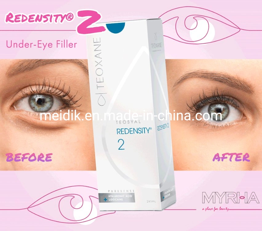 Teosyal Redensity 2 Puresense (2X1ml) Dermal Filler Good Effect, Before and After, Good Interview After Injection, Beauty Salone Use Most for Under Eye Area