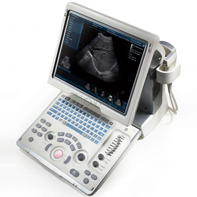 Dp-50 Portable Black and White Ultrasound Scanner