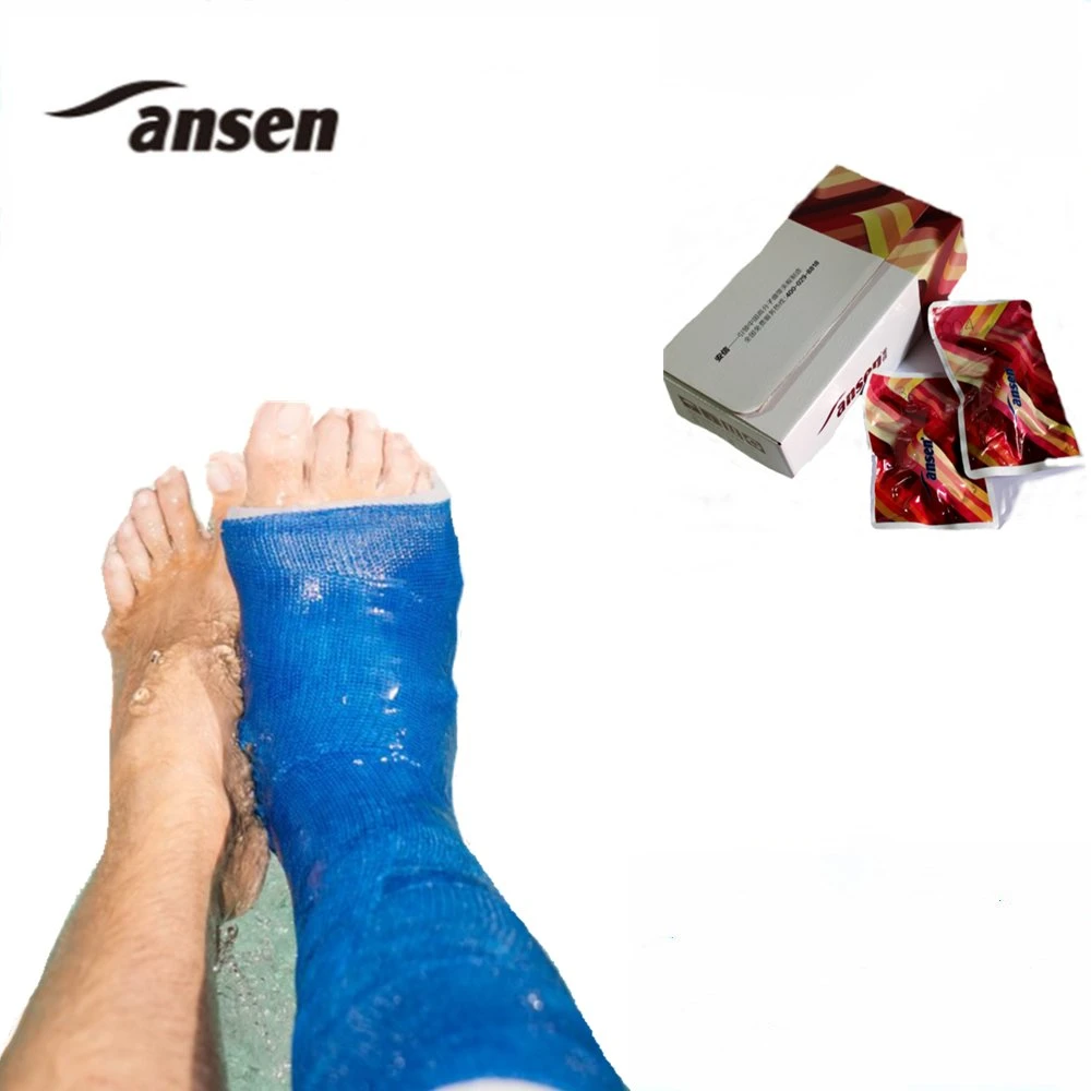 Factory Supply Fiberglass Casting Tape Sterilization Wrap Orthopedic Cast Bandage Fast Moving Hospital Consumer Products
