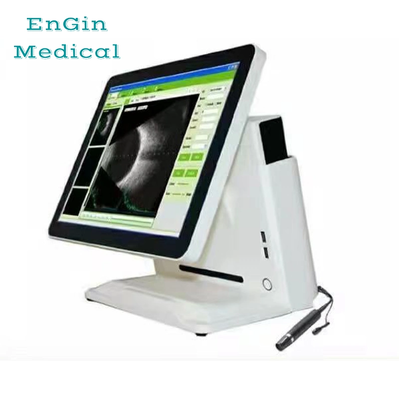 Ecografías oftálmicas Captura de un B-Scan Pachymeter Oftalmología ultrasonido a/b