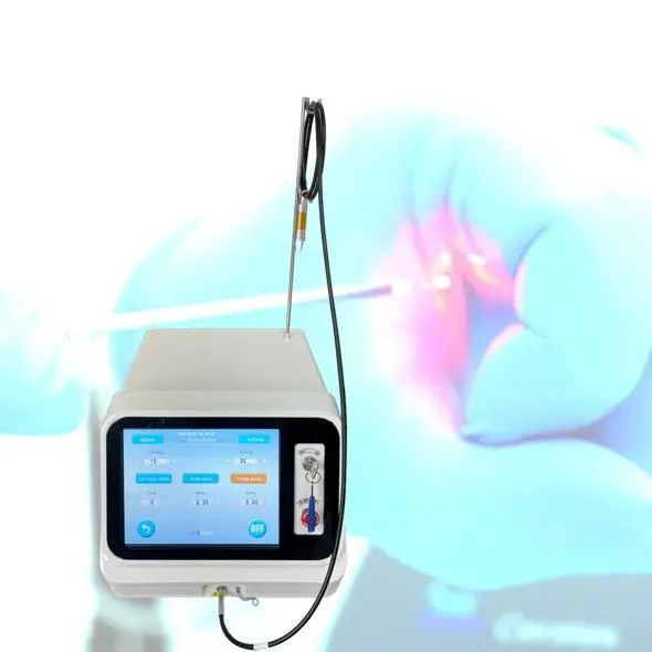 Minimally Invasive Laser 1470 Treatment of Piles/Fistula/Pilonidal Sinus Varicose Veins Hemorrhoids Removal Device