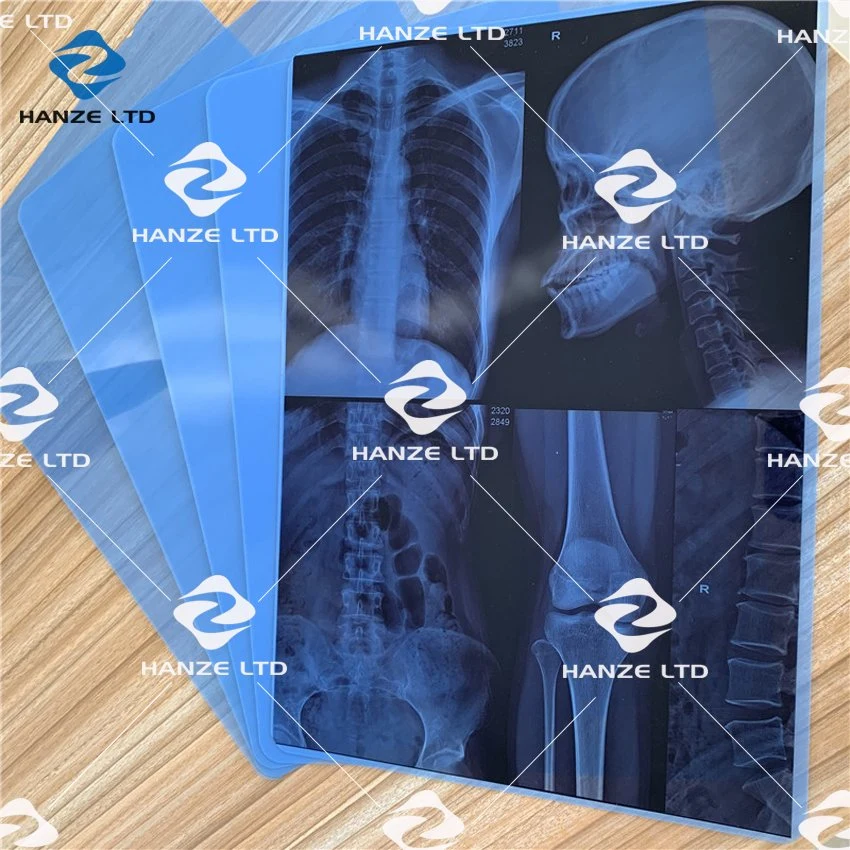 X Ray Film Inkjet Medical Dry Imaging Film for CT/Cr/Dr