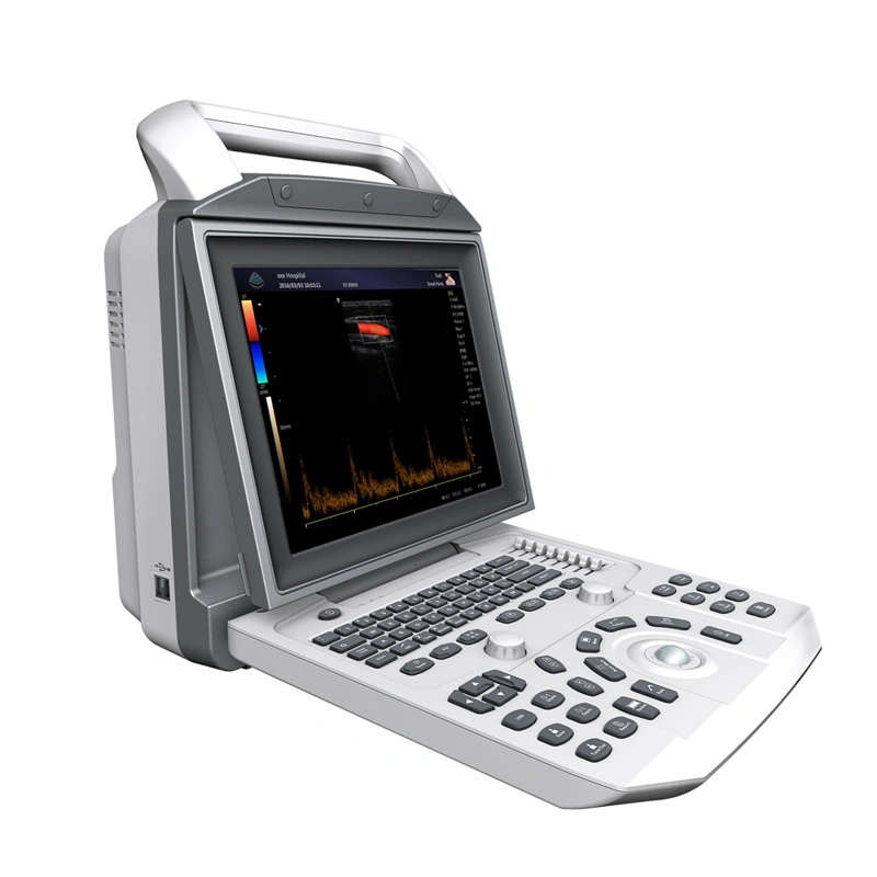 My-A026 All Digital Color Doppler Ultrasonic Diagnostic System 12.1 Inch Portable Doppler Ultrasound Machine