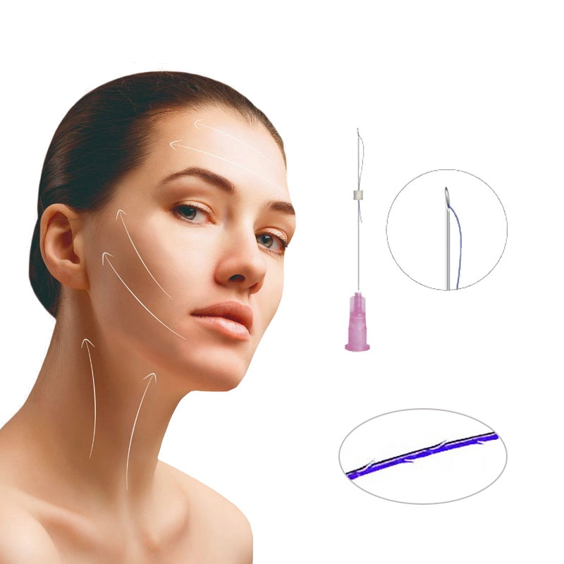 Medical Beauty 3D PDO-Gewinde mit Zahnradschaber/Zahnradschnur