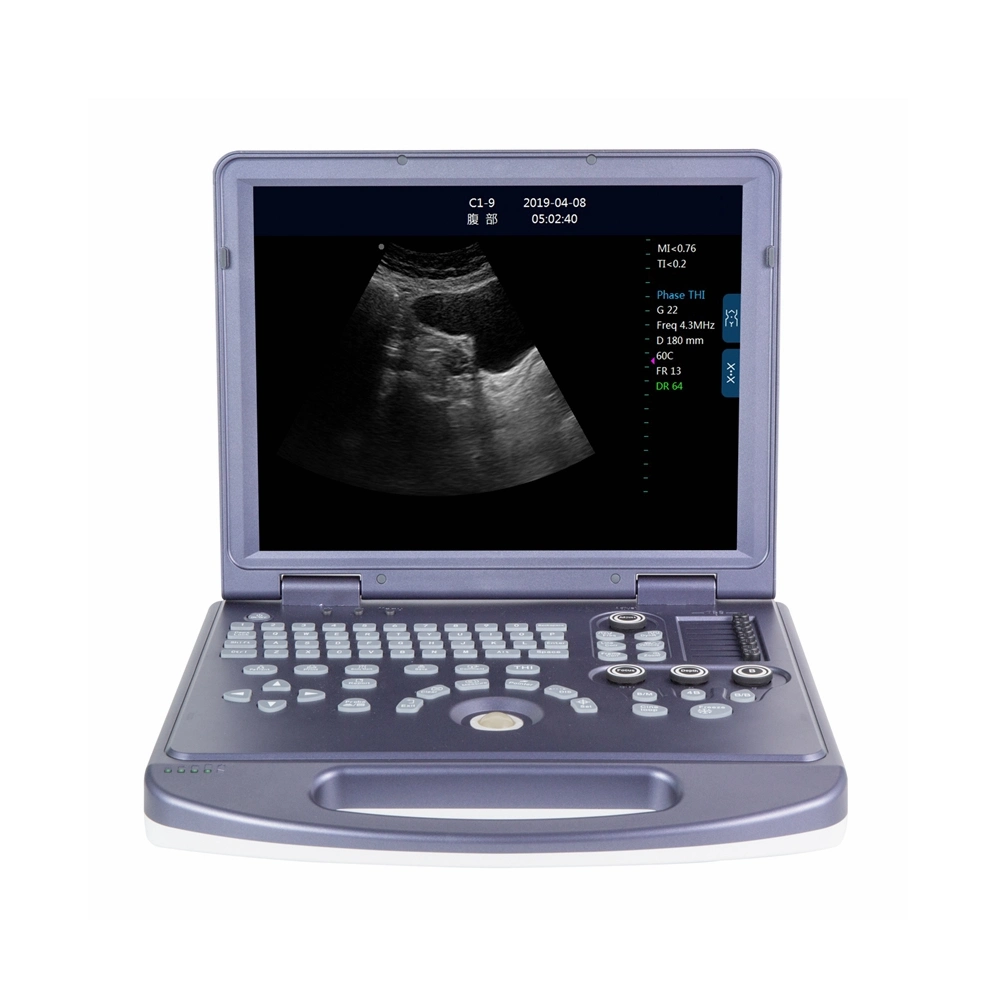 Laptop Full Digital Ultrasonic Diagnostic Instruments Ultrasound Sonography Machine