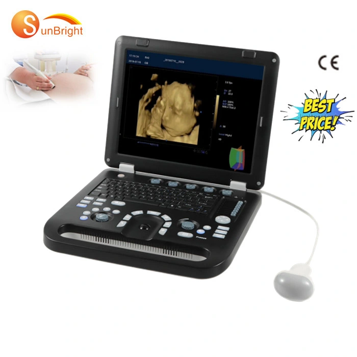 Free 3D Software Professional Medical Color Doppler Ultrasound Device