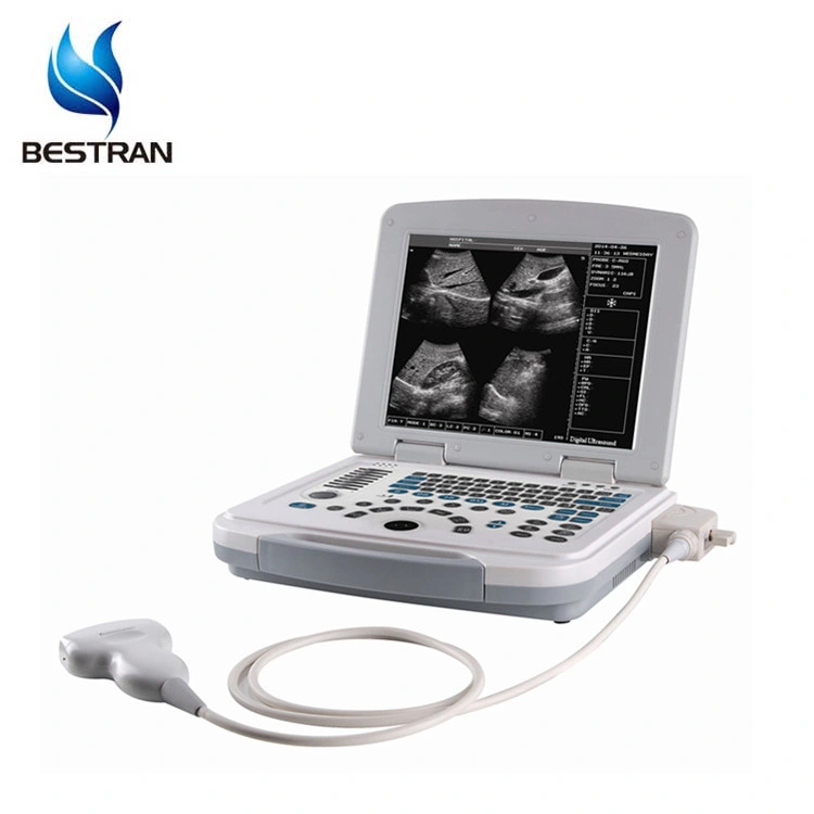 B/W Ob Gyn Urology Vascular Msk Ultrasound Scanner Digital Laptop Ultrasonic Equipment to Human