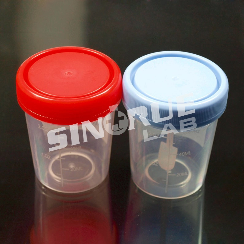 Lab Hospital Disposable Specimen Collection Cup