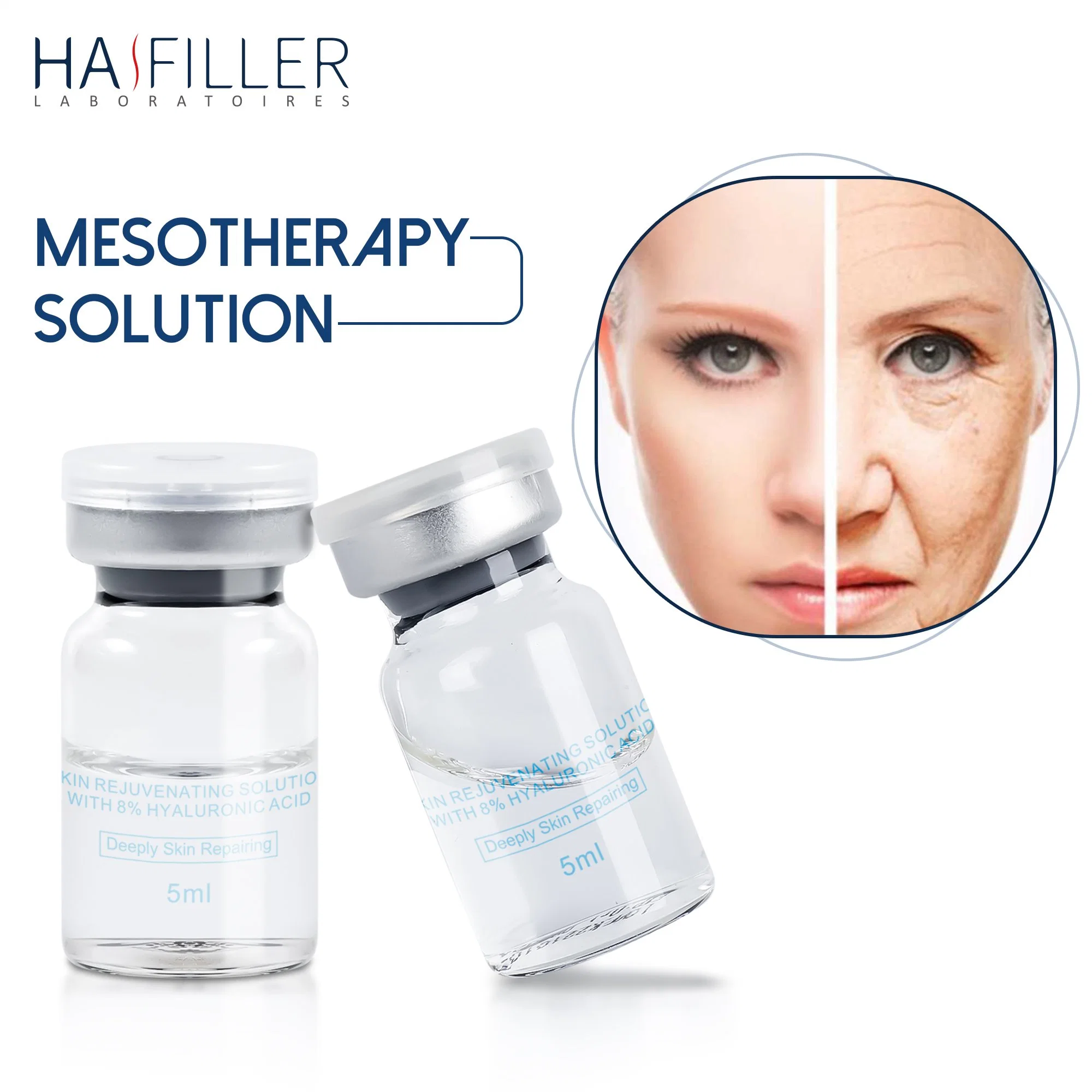 New Product Launch Anti Aging Hydration Skin Rejuvenation Containing 8 Percent Hyaluronic Acid Products Skin Booster Injection Beauty Mesotherapy