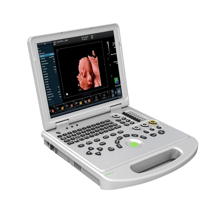 China Manufacturer Price Hospital Medical Diagnosis 3D 4D 5D HD Imaging Scan Laptop USG Scanner Portable Color Doppler Ultrasound Machine for Sale