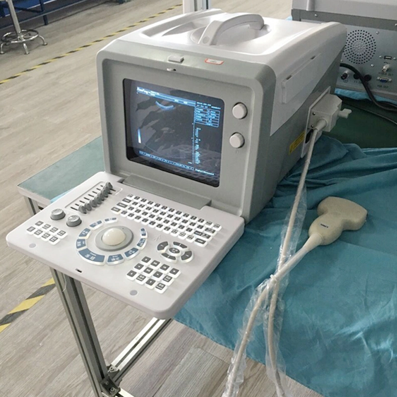 Hc-A001 d'échographie portable numérique complet Machine Scanner/le moins cher d'instruments à ultrasons médicaux