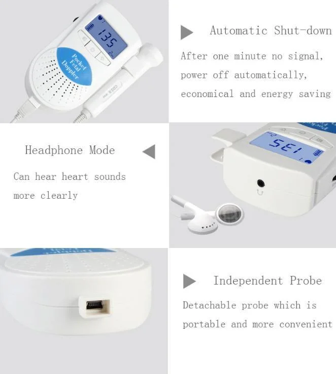 Hochey Medical Factory Direct Wholesale/Supplier Price Doppler Fetal Ultrasound Baby Heart Detector Good-Looking Fetal Heart Monitor