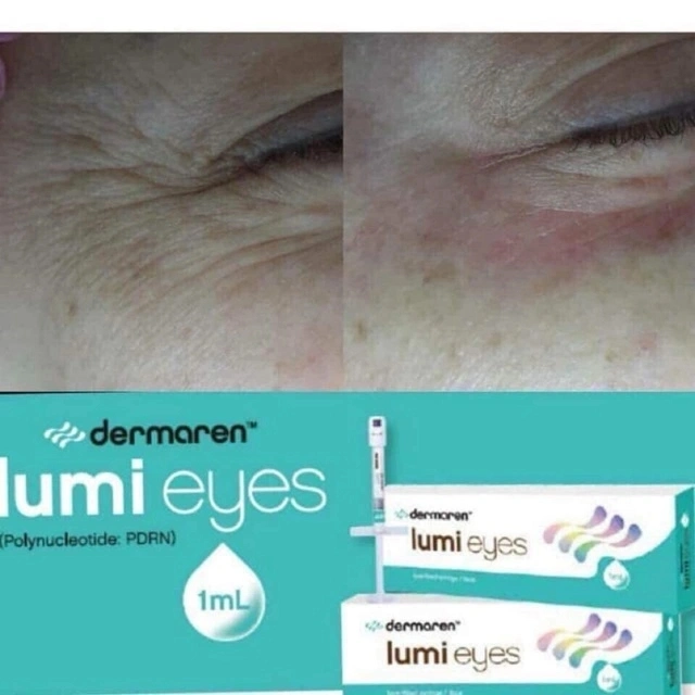 Corée Dermaren Lumi Eyes Eye Bag Noir Circletreatment Pdrn anti-âge Rides cercle foncé traitement de la zone oculaire remplissage dermique injectable Hyaluronic Acide