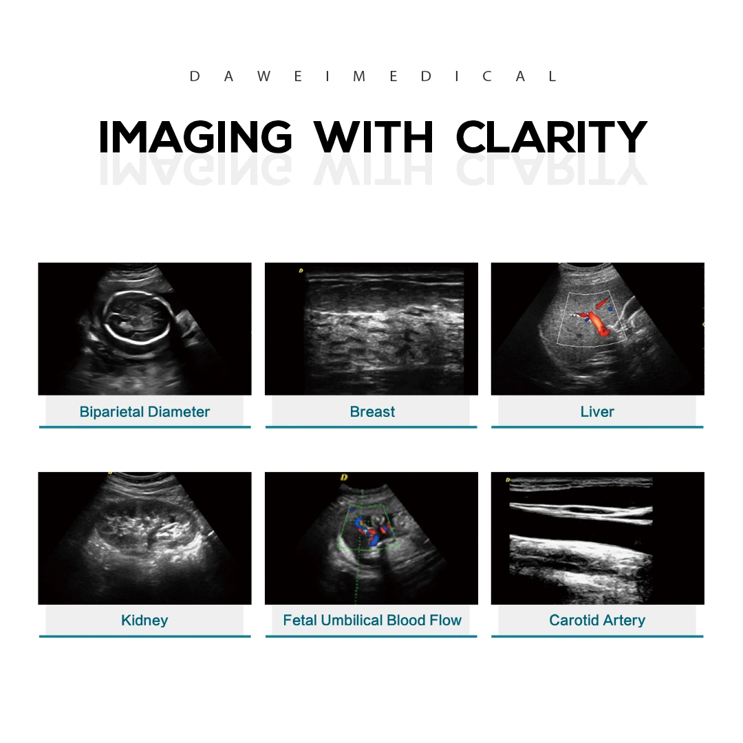 Dawei CE Certified Hospital Trolley Ultrasound Dw-F3