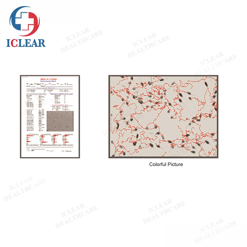 4ª Versão de Software Notebook Ultraportátil Análise de sémen Analisador de esperma para uso de EFP