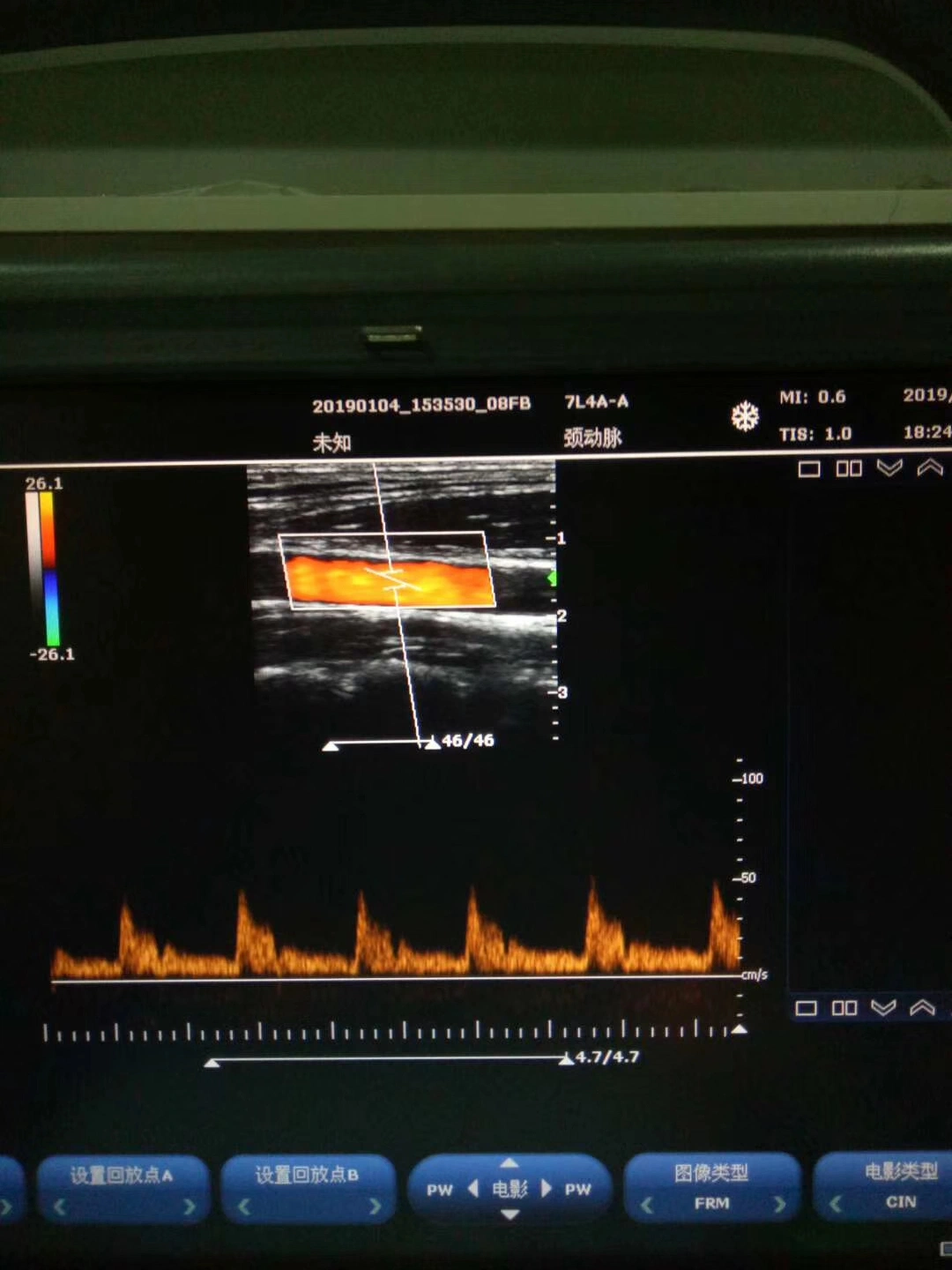 Veterinaria portátil digital Sistema de ecografía Doppler Color, la fábrica de bajo precio para clínica veterinaria, el Centro de Servicio Vetetery