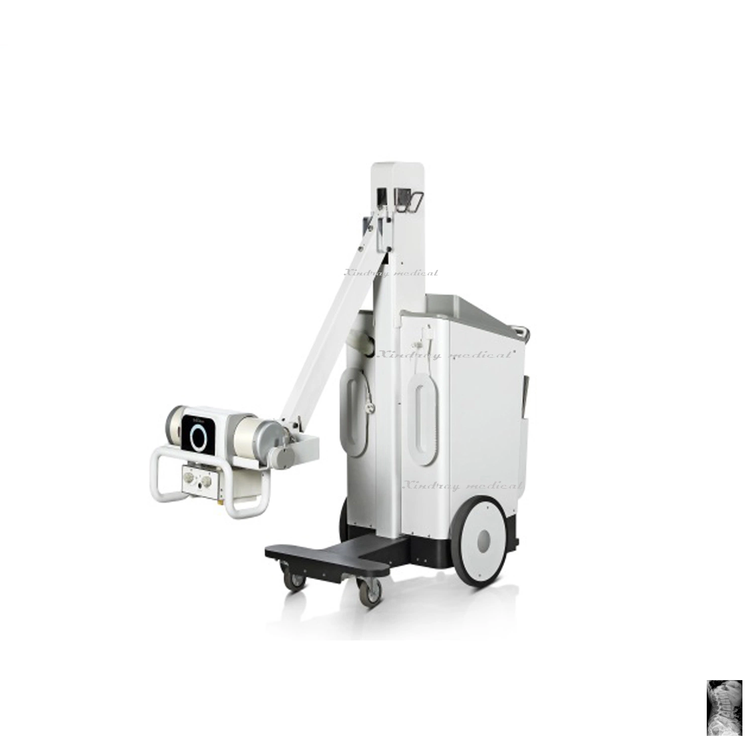 Popular Hot Selling X-ray Machine for Examination All Body with Mobile Trolley