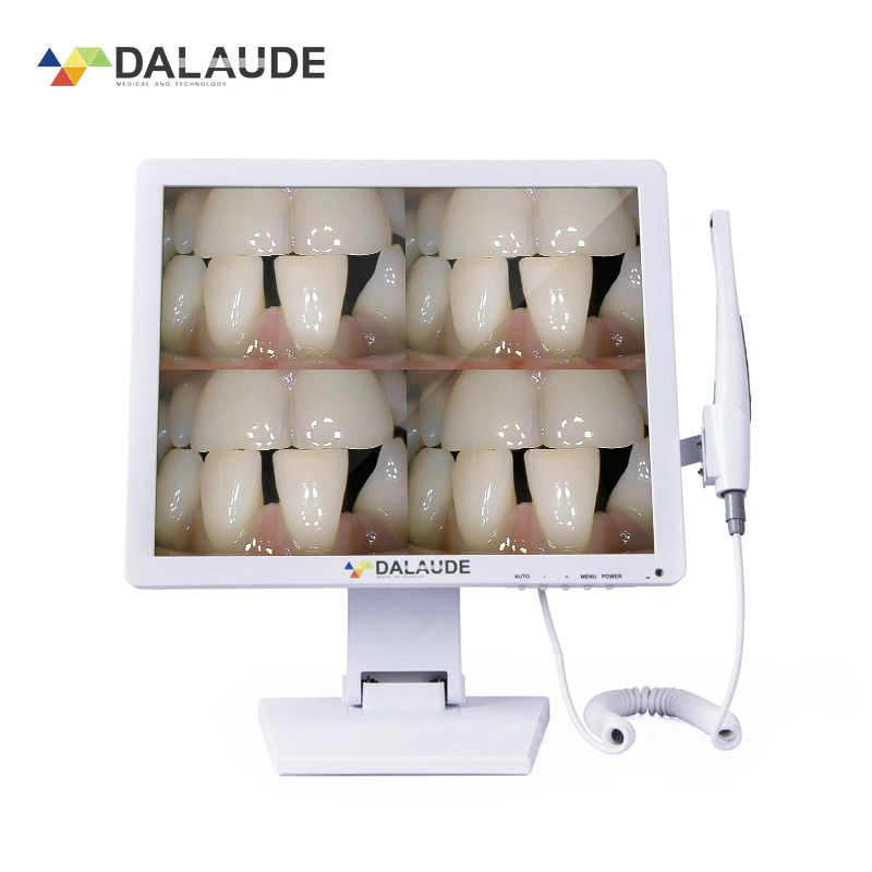 Caméra intra 0ral châssis LCD dentiste dents de l'appareil photo pousses