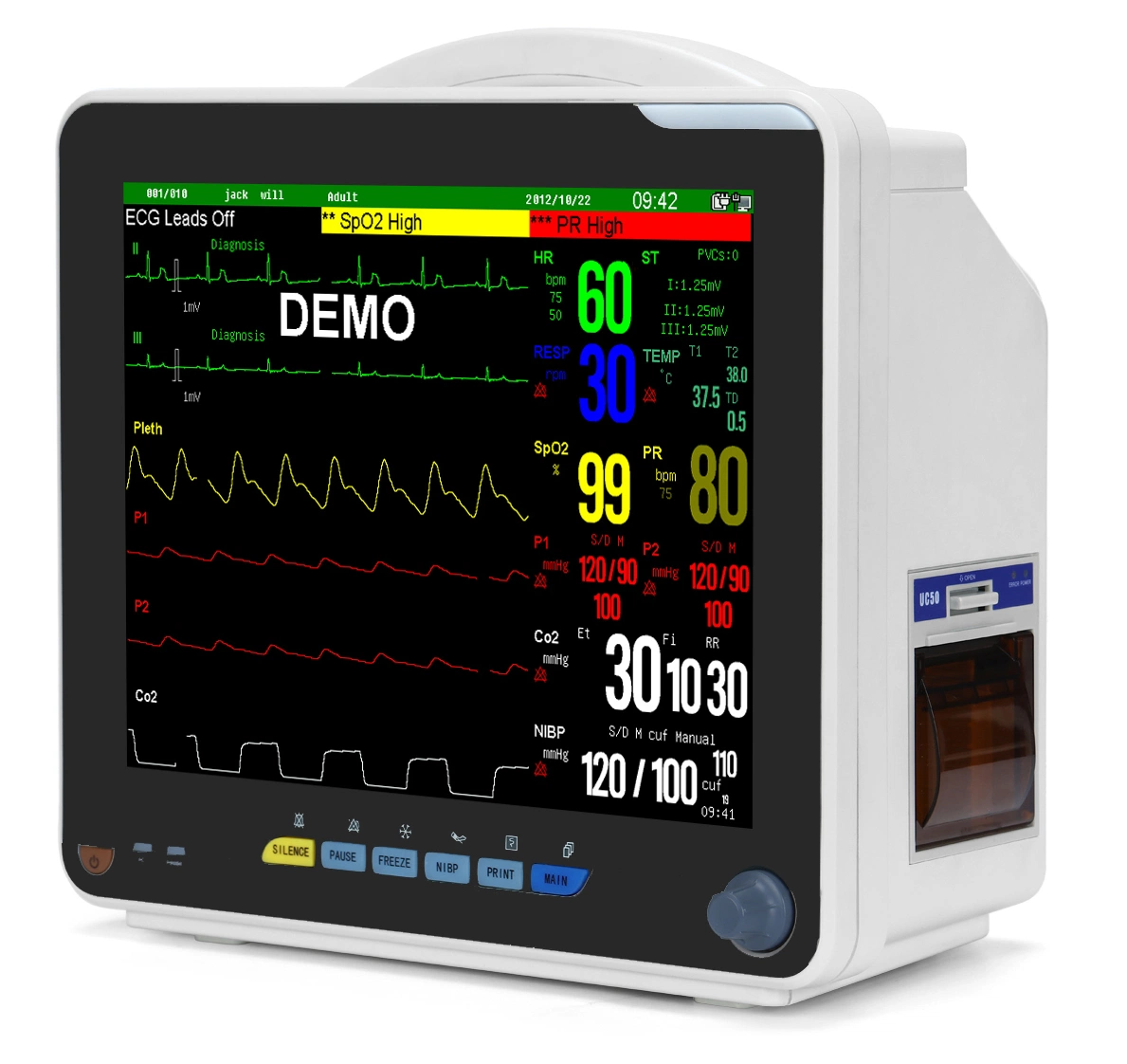 ICU Medical Multi-Parameter moniteur de chevet portable moniteur patient, les signes vitaux, moniteur cardiaque