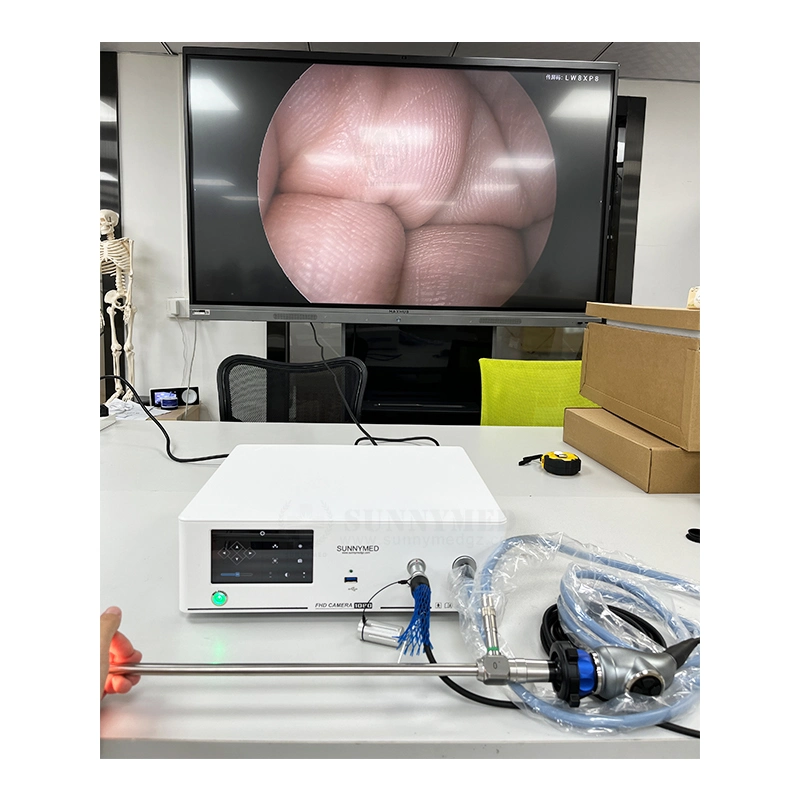 Sy-PS048t New Arrival HD Camera Rigid Endoscope Integrated Camera and Light Source System