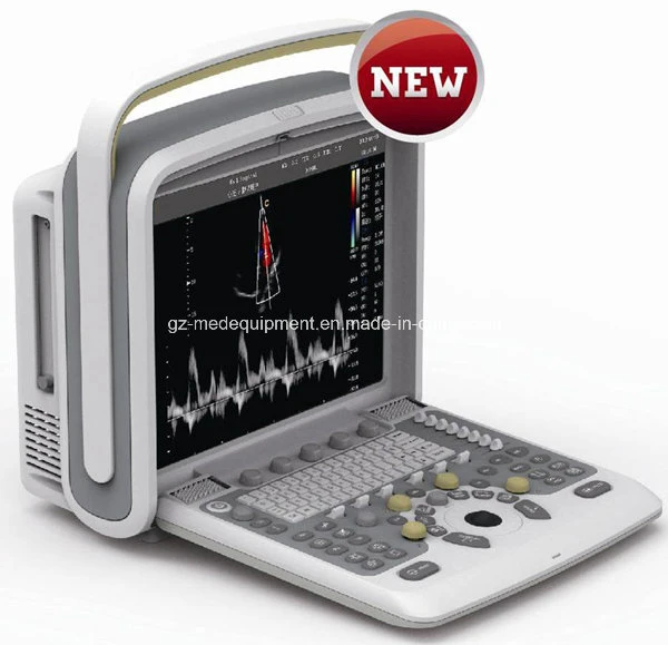 Color Doppler Medical Equipment 2D 3D 4D Portable Ultrasound Scanner (7 Models for your Choice)