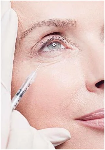 Eye Wrinkle Korea Dermal Filler Hyaluronic Acid Injections Gel for Lip Body Breast Buttocks Hip Facial Wrinkles Face Contour Medical Beauty Plastic Surgery