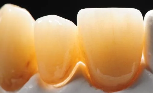 Dental Zirconia Ceramic 3D Multilayer Zirconia Blocks