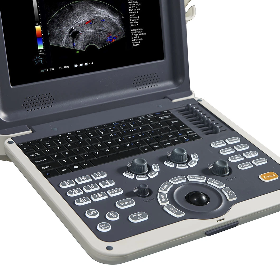 Medical Diagnostic Equipment Portable Digital Color Doppler 4D Ultrasound Scanner