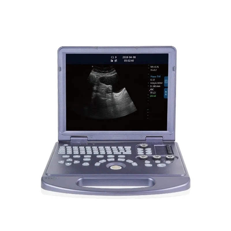 Medical B/W Portable Ultrasound Machine with Cheap Price (THR-USC60)