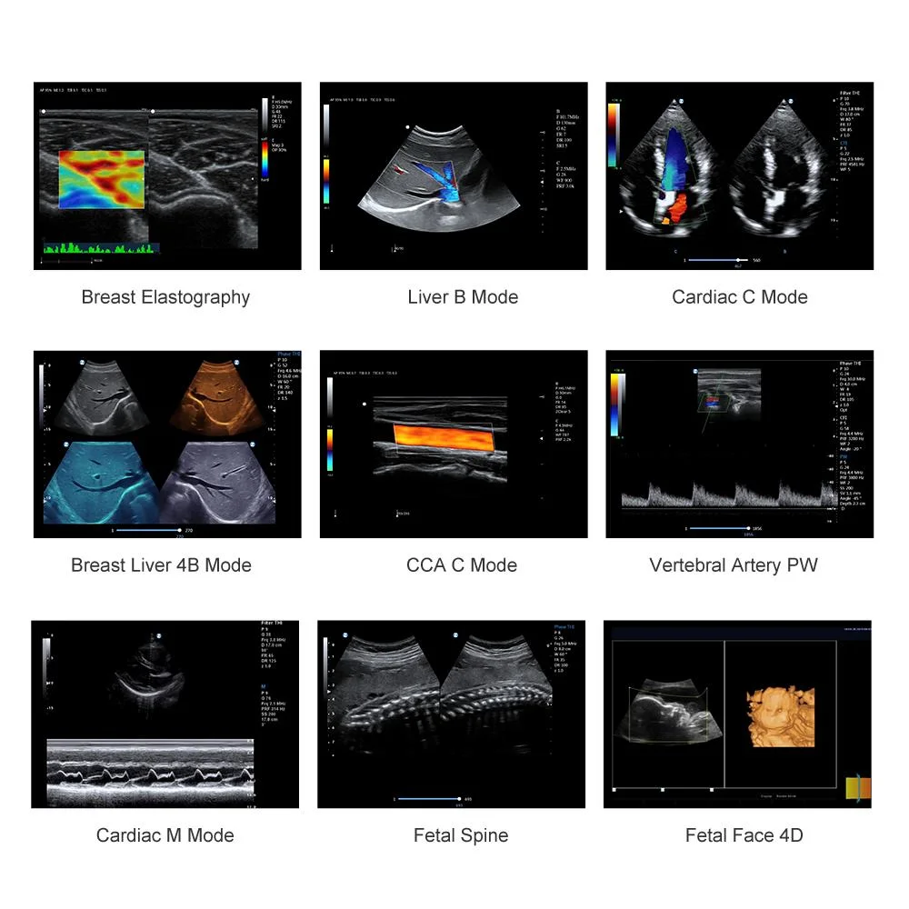 Meu-A031b Carrinho Ecografo 3D 4D ultra-sonografia com Doppler colorido, scanner de ultra-som cardíaco Digital