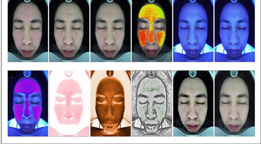 New Technology 3D Skin Test Moisture Detector Facial Scanner Analyzer Device 3D Skin Analysis Machine