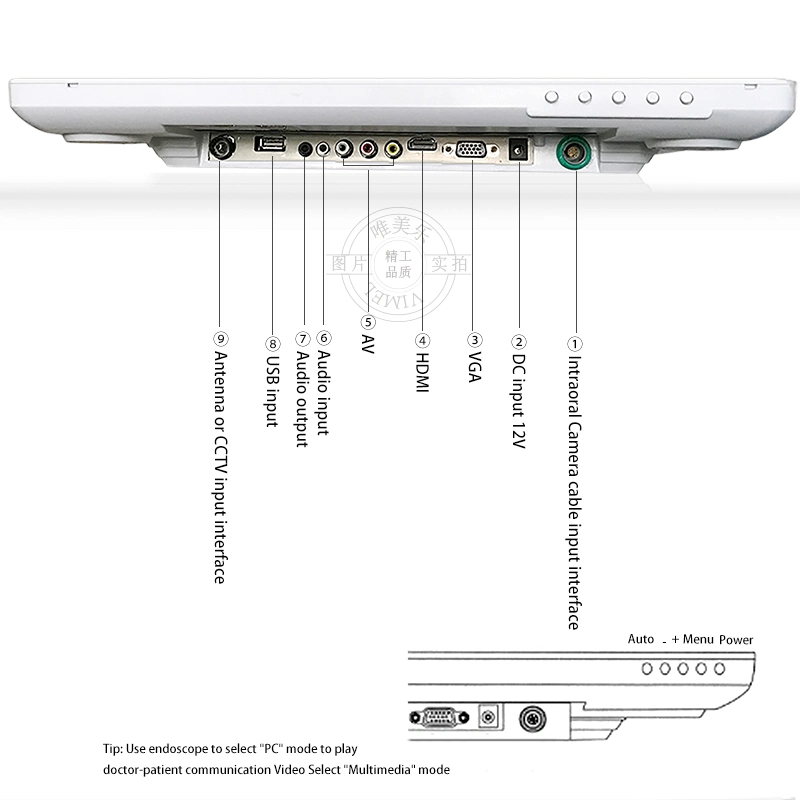 Appareil médical appareil-photo intra-buccal dentaire avec moniteur endoscopes oraux