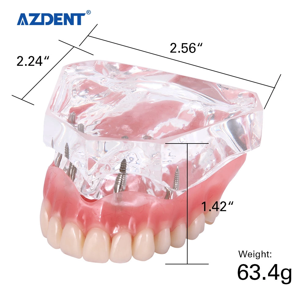 High quality/High cost performance CE Certified Standard Plastic Dental Implant Teeth Model