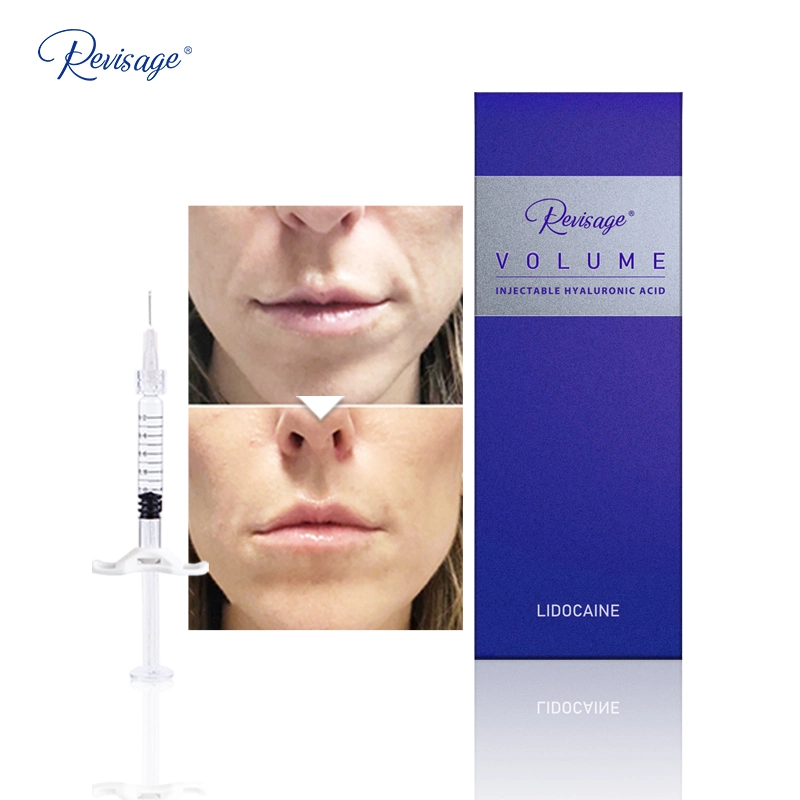 Revisage Best Deep Wrinkle Filler Injections Filler 1 Ml Lip Hyaluronic Acid Filler 1ml Syringe