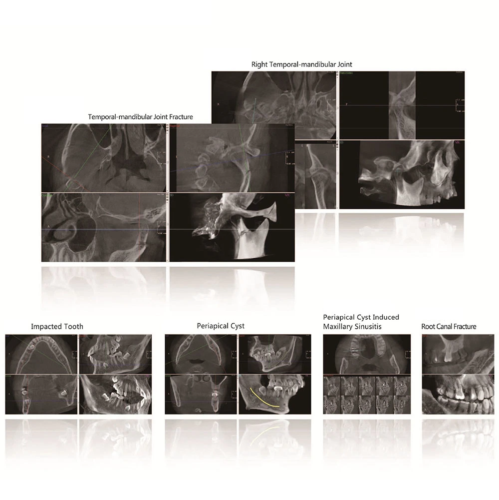 H-X9010d PRO 3D Digital Cbct Dental Panorámica de la máquina de captura de rayos X