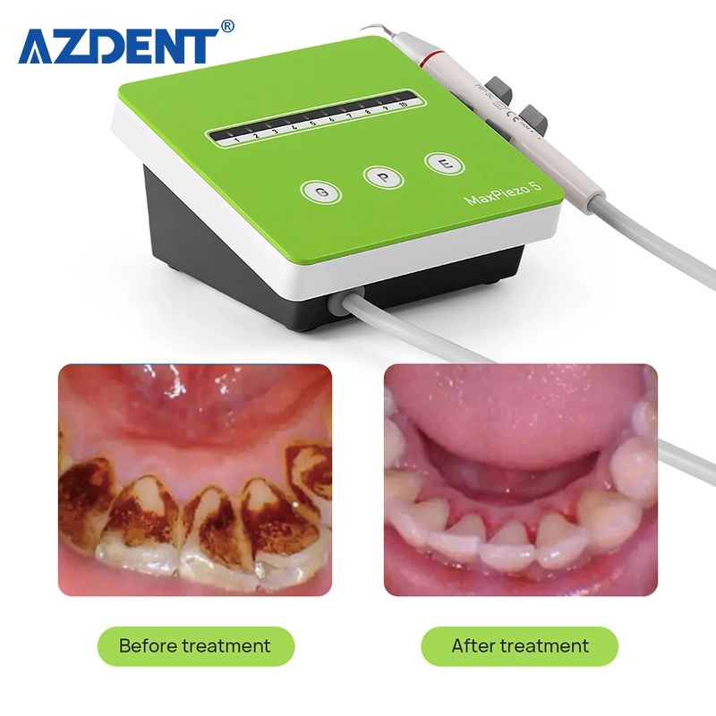 Nuevo portátil de la fibra óptica dental Piezo escalador de ultrasonidos