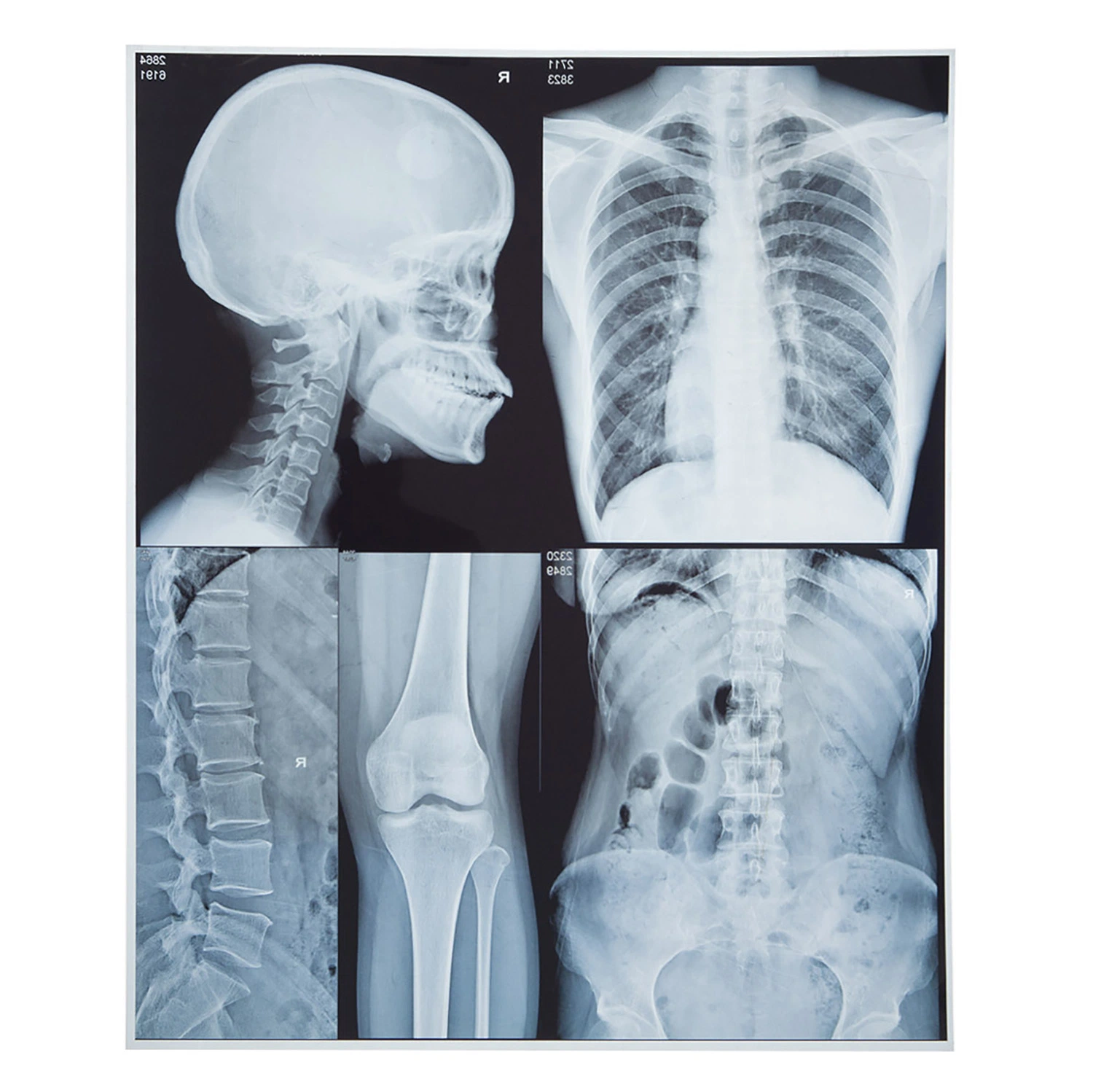 ISO 13485 und Tintenstrahl-Digitalisiertes Bild des Cer-Standardzoll-10*12