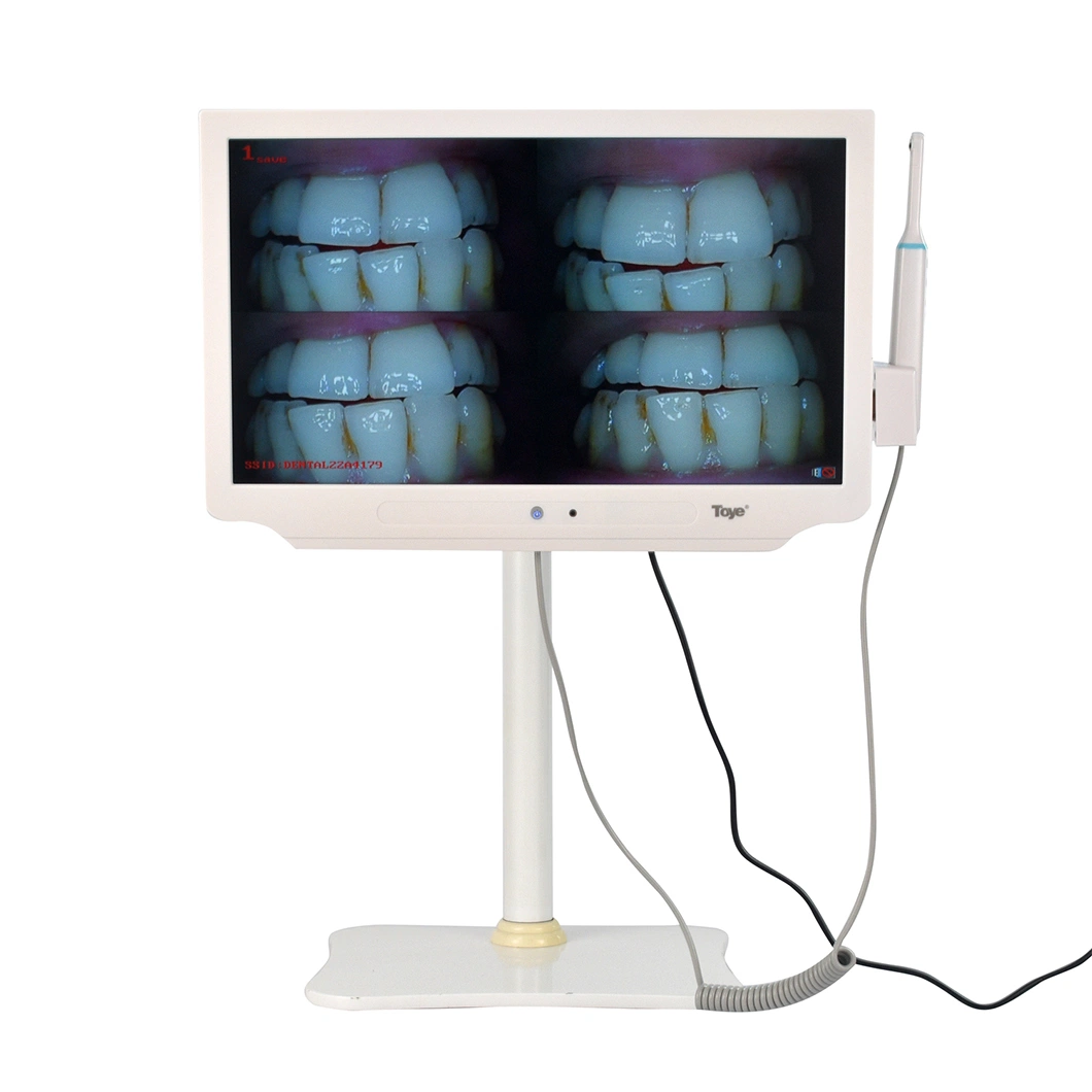 Appareil photo intra-buccal tout-en-un avec système d'endoscope dentaire WiFi de surveillance en option