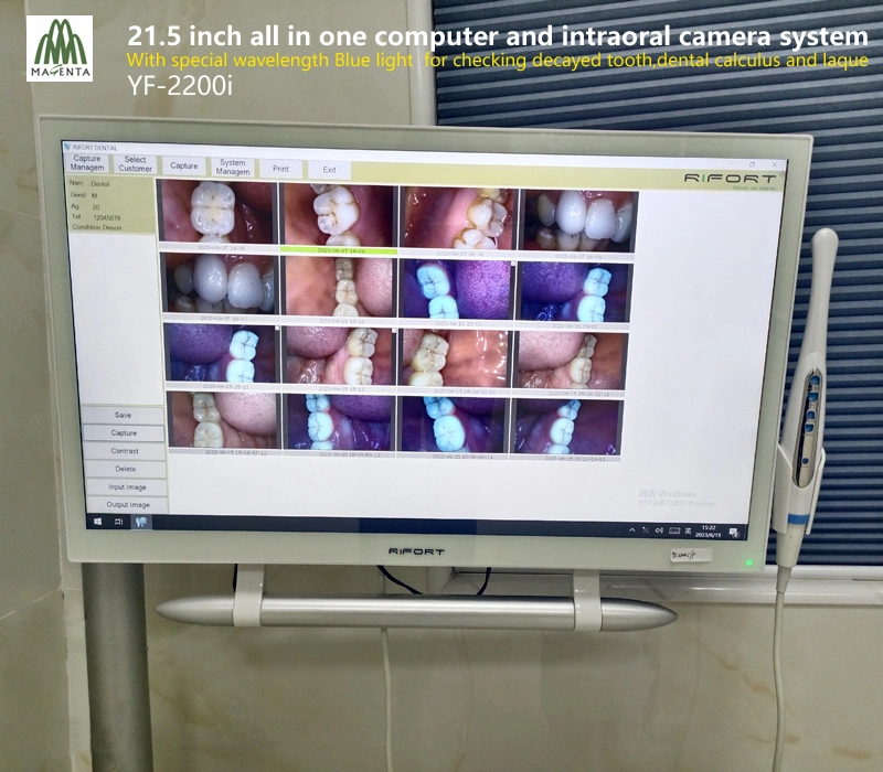 Ordenador dental con pantalla táctil y cámara intraoral HD Blue Light Unidad para verificar el diente/cálculo y la placa decaídos