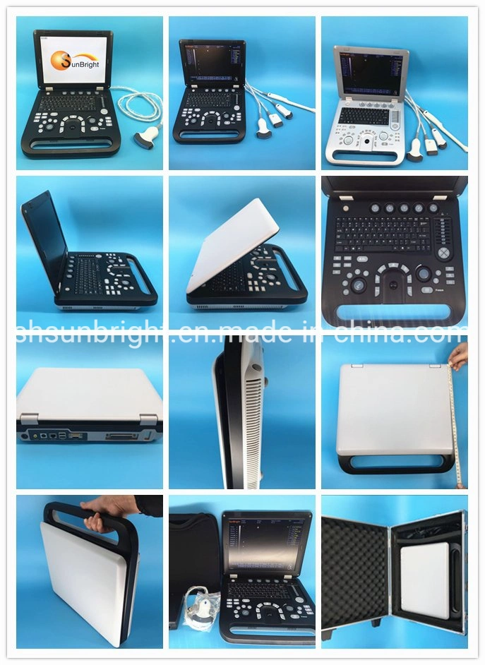 China Portable Msk Ultrasound 3D/4D Medical Full Digital Ultrasound Diagnostic